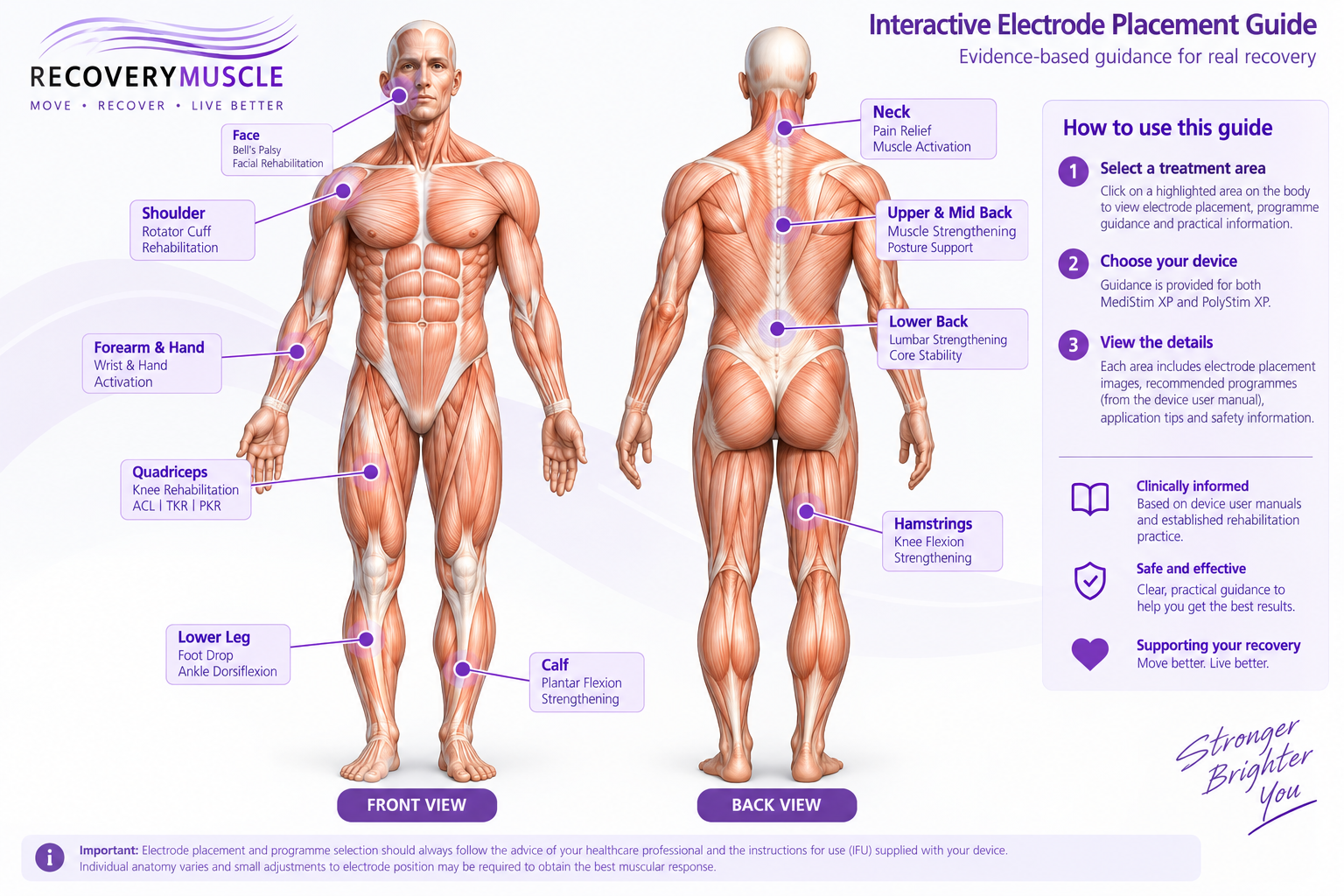 Recovery Muscle interactive electrode placement guide showing common treatment areas